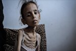 Total Deaths of Palestinians Dying from Starvation in Gaza near 170